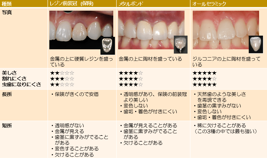 歯の詰め物や被せ物、どういう基準で材質を選んだら良いか？｜六本松